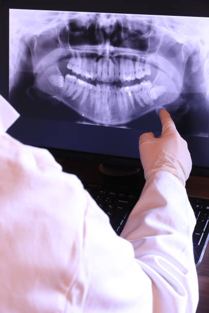 Best Emergency Treatment for Dental Infections or Abscesses in Victoria, VA