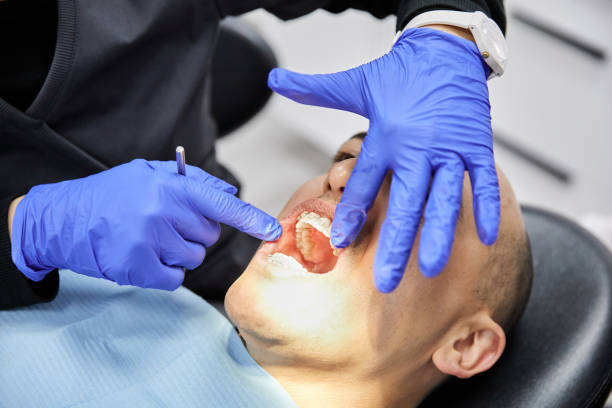 Best Emergency Dental Care for Broken or Chipped Teeth in Victoria, VA
